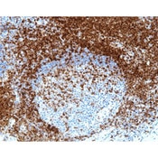 CD5